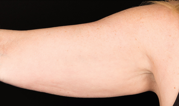 Real results, so you can reveal those upper arms